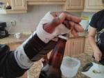 Gipsarm bieropener